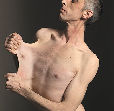 Garry-Turner-stretchiest-skin