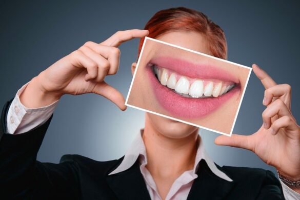 Tips Para Mantener Una Sonrisa Perfecta Todo El Verano
