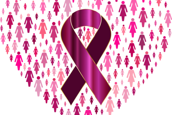 El Cáncer De Seno Principal Causa De Muerte Entre Las Hispanas