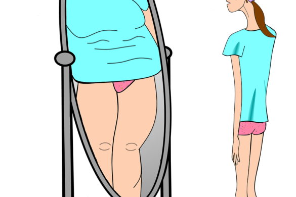 Eating Disorder Claim Lines Increased 65 Percent Nationally